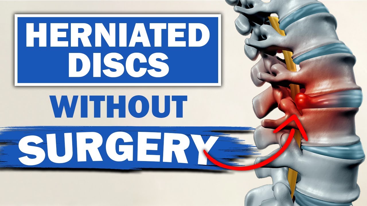 Should I Have Surgery For A Disc Herniation Pros & Cons