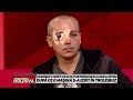 MOLDOVA SPEAKS THE ALBA IULIA TRAGEDY