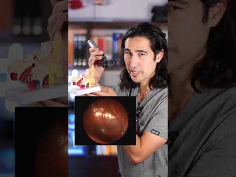 How Doctors Look Inside Your Ears #doctor #otoscope #ears