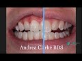 IMG 6426 TRIM