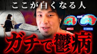 ※この症状が出たら鬱確定※MRIでも分かる。これが謎多き病の正体です【 切り抜き 思考 論破 kirinuki hiroyuki】