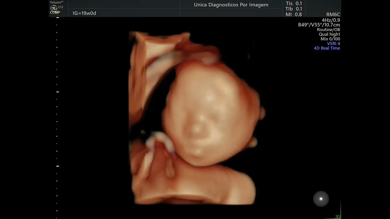 Ultrassonografia 4D HD Live: veja seu bebê com mais detalhes antes do nascimento