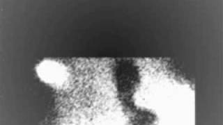 Red Lorry Yellow Lorry - talk about the weather