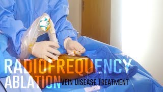 Radiofrequency Ablation | Vein Disease Treatment | Vein Treatment Center