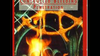 Controlled Bleeding - Now is the Time