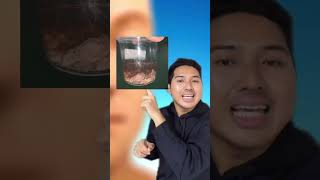 OPERASI SINUS DENGAN METODE FESS #yangfarhantahu