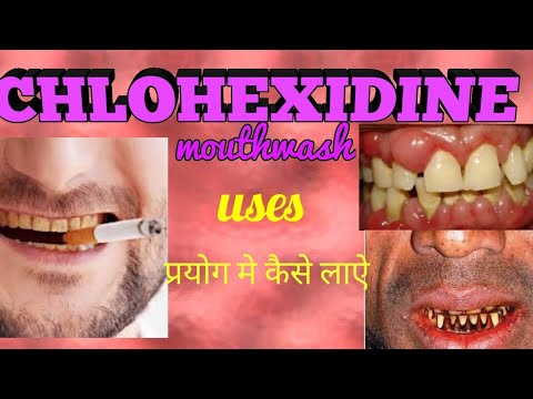 Chlorhexidine mouthwash uses
