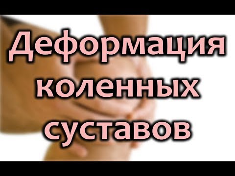 Боль в левом локтевом суставе при сгибании Сустав кисти вышел