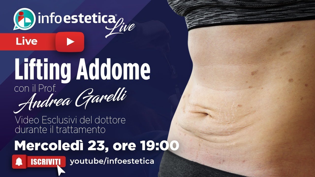 Watch Now Lifting Addome con fili di trazione - Diretta con Prof. Andrea Garelli e paziente Lifting Addome con fili di trazione - Diretta con Prof. Andrea Garelli e paziente