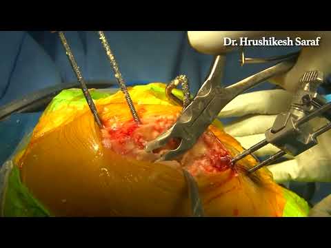 Dr. Saraf's Joints Clinic|Karve Road ,Pune