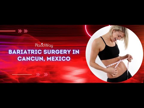 Watch Video on Bariatric Surgery in Cancun, Mexico