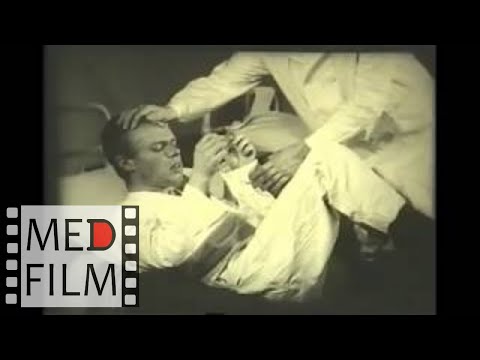 Schizophrenia: catatonic syndrome, stupor - treatment &copy;