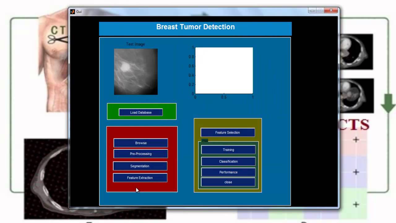 Matlab Simulation Projects |  Best Matlab Simulation Projects