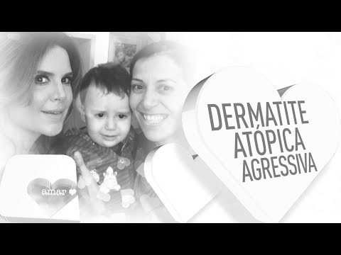 Respostas polisorb de eczema Clínicas em tratamento de psoríase em respostas de Moscou