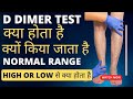D dimer test kya hota hai | d dimer test in Hindi | d dimer normal range