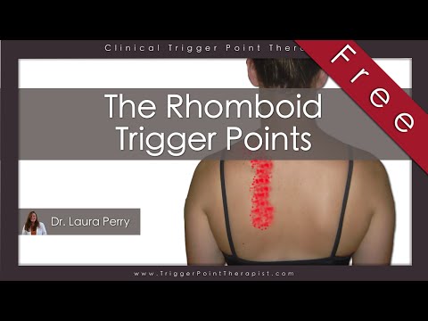 The Rhomboid Trigger Points (Free Full Video)