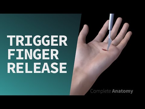 Trigger Finger Release