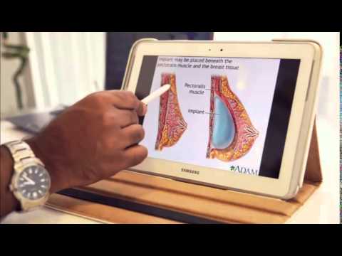 Breast Augmentation Bangalore