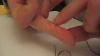 Fantastic Feat of Fortitude #22 - Blister Self Surgery