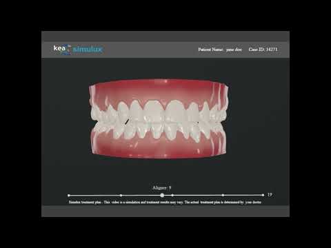 Download Staging Video