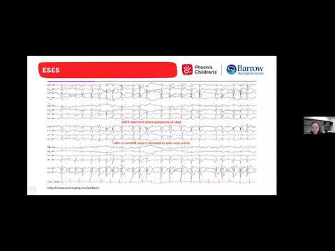 NSGR: Sleep and Epilepsy led by Michelle Yun, MD on 1/13/25