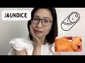 Jaundice in Babies : When to Worry | Dr. Kristine Alba Kiat