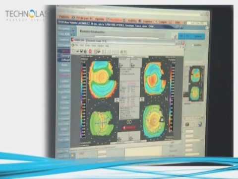 PRESBYLASIK, correction de la presbytie au centre Vision Future Nice