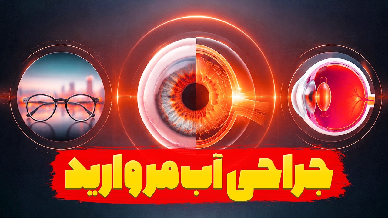آب مروارید را دیر عمل کنیم چه می‌شود؟ پاسخ متخصص چشم
