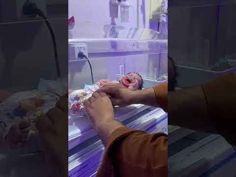 TTN Baby in NICU – Transient Tachypnea of Newborn Explained 🩺👶 #nicubaby #bravebaby #baby #nicu