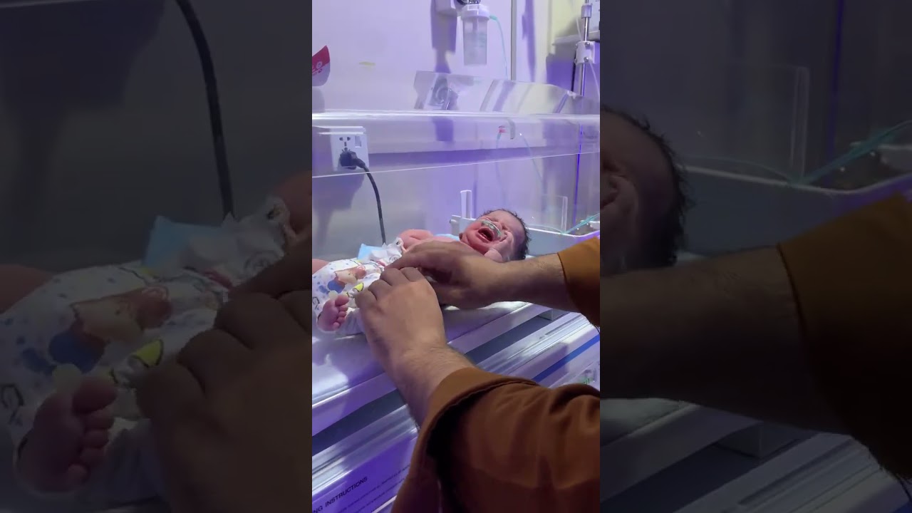 TTN Baby in NICU – Transient Tachypnea of Newborn Explained 🩺👶 #nicubaby #bravebaby #baby #nicu