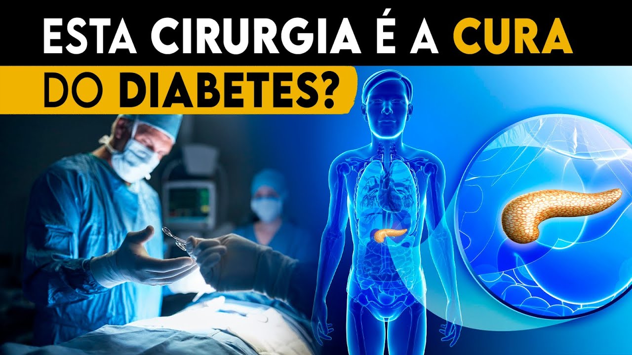 Como é a CIRURGIA que CURA o DIABETES? (Cirurgia Metabólica) │ Médico Explica