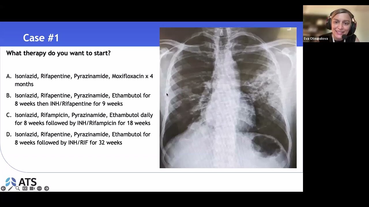 New TB Treatment Guidelines: A Clinician’s Guide to the ATS/CDC/ERS/IDSA 2025 Update