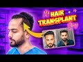 My Hairtransplant Journey - Elvish Yadav