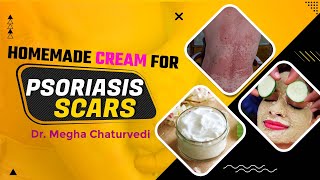 Homemade Cream For Psoriasis Scars | Best Cream For Psoriasis Patient | Dr. Health