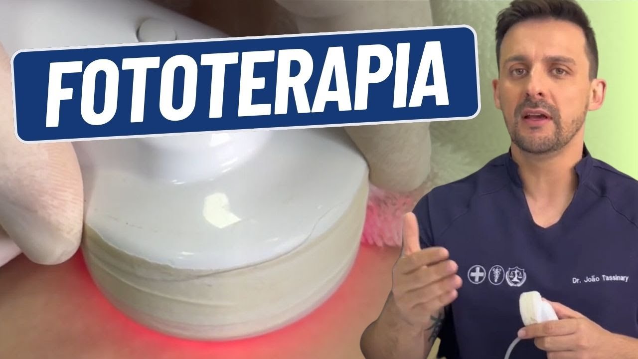 COMO APLICAR FOTOTERAPIA | DR. JOÃO TASSINARY