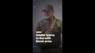 Ukrainian soldier learns to live with bionic arms
