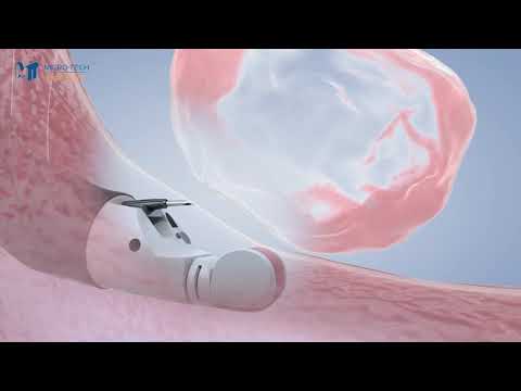 NEW EUS Needle   USA