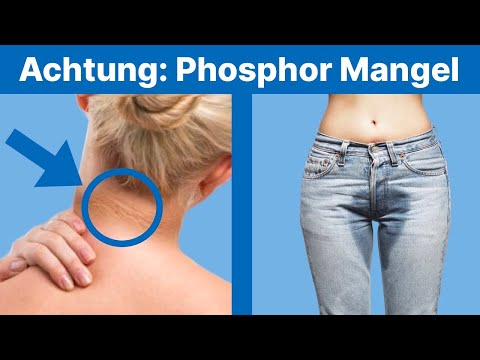 So erkennst du einen akuten Mangel an Phosphor! (Nicht ignorieren)