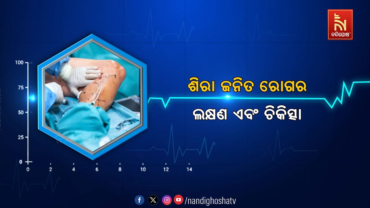 🔴 Live | ଶିରା ଜନିତ ରୋଗର ଲକ୍ଷଣ ଓ ଚିକିତ୍ସା | NandighoshaTV