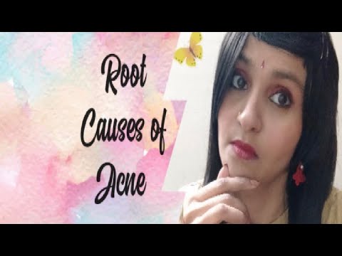 What Your Acne Says about Your Health | ROOT CAUSES OF ACNE & PIMPLES | #SkinCare | #styloshipra