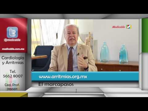 ¿Cuáles son los síntomas que presentan las personas que requieren un marcapasos?