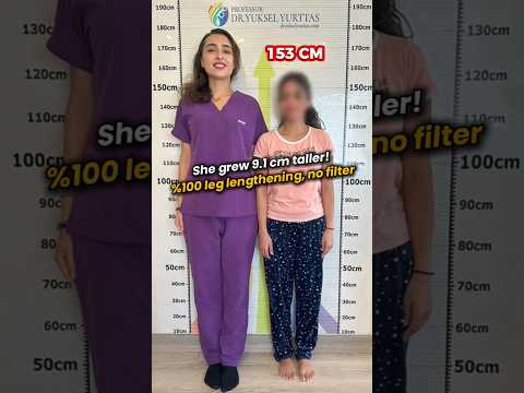 154 cm to 163 cm | +9.1 cm Taller - Leg Lengthening Surgery Result #shorts