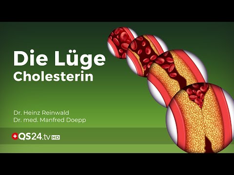 Schmerzt ein Auge bei Diabetes Niedrigste Bluttest für Zucker