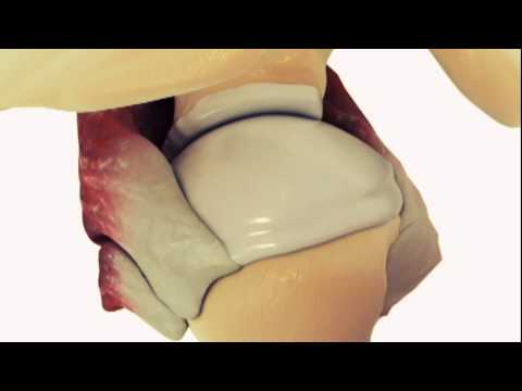 Force couples of the shoulder