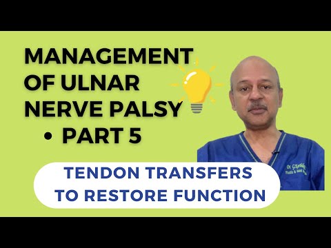 Management of ulnar nerve palsy: Tendon transfers to restore function
