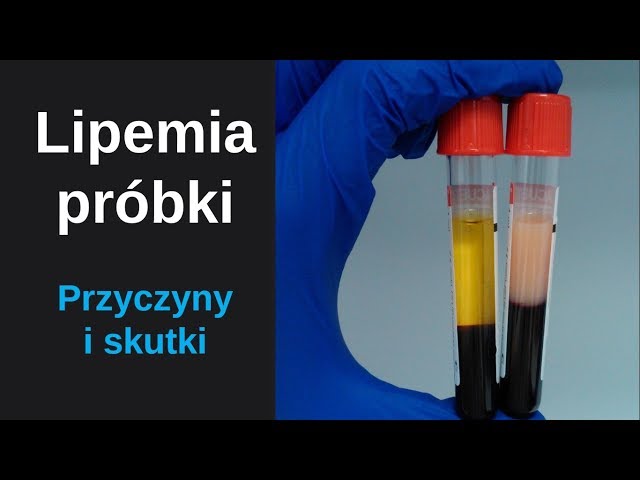 Видео Произношение lipemic в Английский