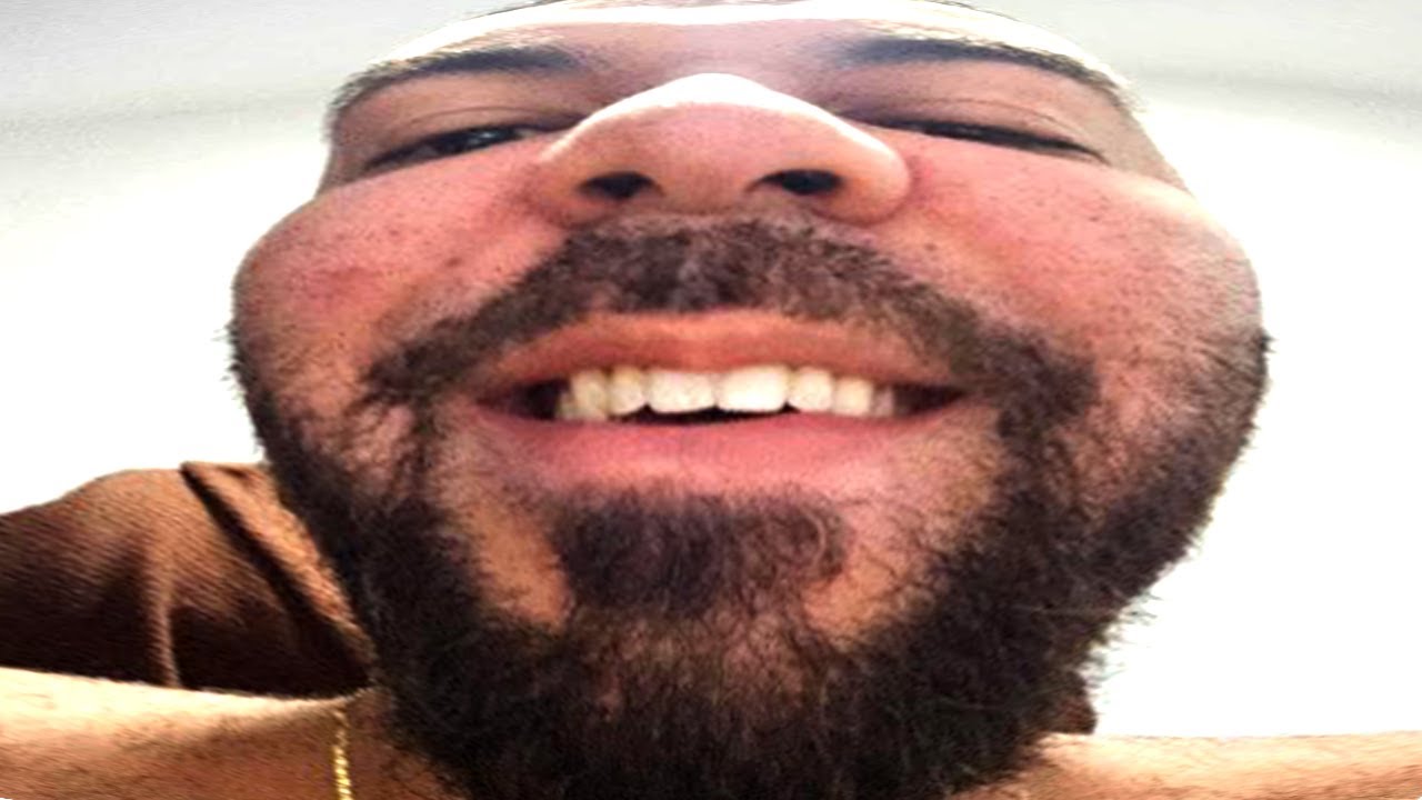 ME AJUDEM A TER CABELO NOVAMENTE