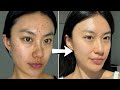 How I Cleared My Skin In A Week With 0