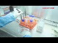 Mesenchymal Stem Cell Wharton S Glue Treatment