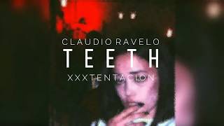 XXXTENTACION - Teeth (Sub Español-English)